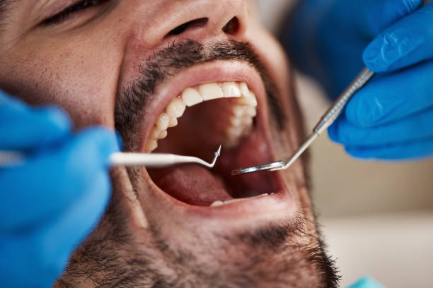 Best Emergency Dental Care for Broken or Chipped Teeth in Tarboro, NC