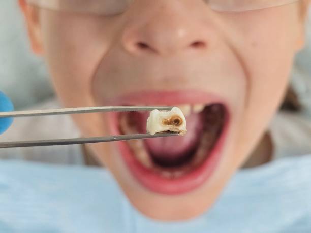 Best Emergency Dental Care for Broken or Chipped Teeth in Tarboro, NC